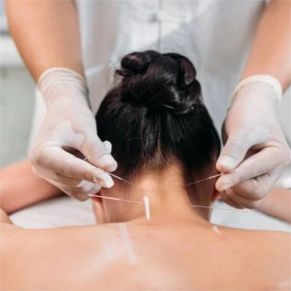 Docteur Chia-Chi Chang - Acupuncture